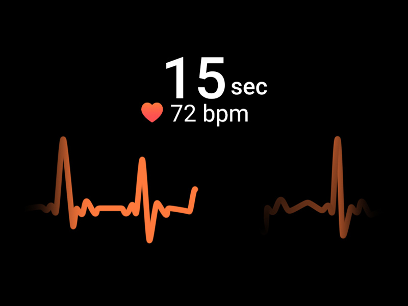 monitorización del ritmo cardiaco